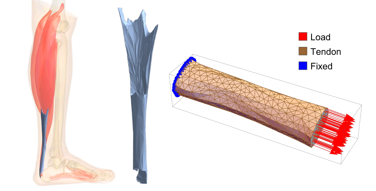 Improving Patient Movement Recovery with Wolfram Language Biomechanics